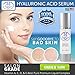Hyaluronic Acid Serum, Vibrant Elastic Skin Again, Scientifically Designed Anti-Aging, Anti-Wrinkle Complex Packed With Vitamins A, C, D, And E-Superb Moisturizer Results In Timeless Glowing Skin