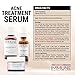 NEW! IMMUNE Acne Treatment System (30 Day) | Natural, Gentle & Effective | Concentrated Botanical Extracts + Salicylic Acid