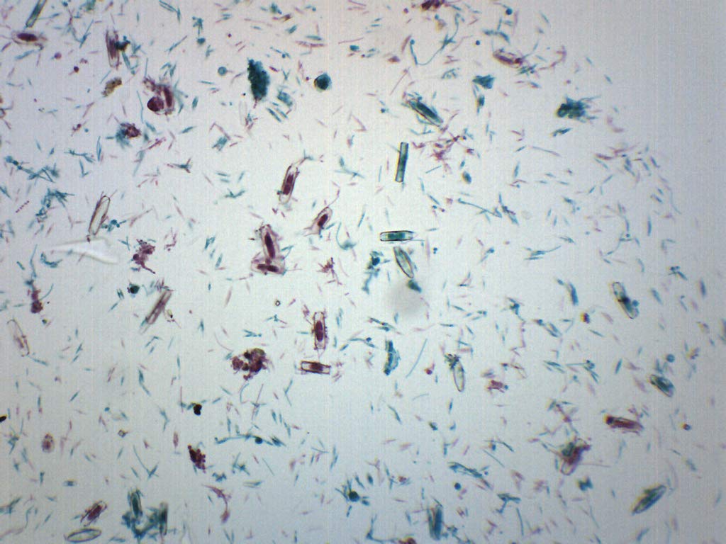 w.m Microscope Slide Freshwater and Marine Diatoms tillescenter