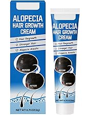 Amazon.com : ALOPECIA Amazing Hair Growth with Biotin 4oz : Beauty