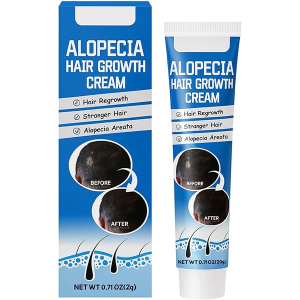 Amazon.com : Alopecia Renewal Hair Loss Treatment | Renewal Hair