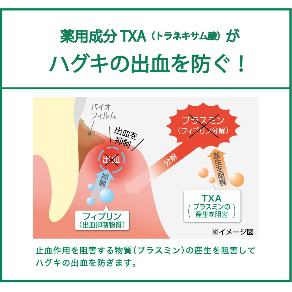 Mua Gum Periodontal Pro Care Dental Paste Quasi Drug Dental Paste Prevents Periodontal Disease Teether Hug Care High Concentration Fluorine Formulation 1450ppm Normal Type 3 2 Oz 90 G Tren Amazon Nhật Chinh Hang