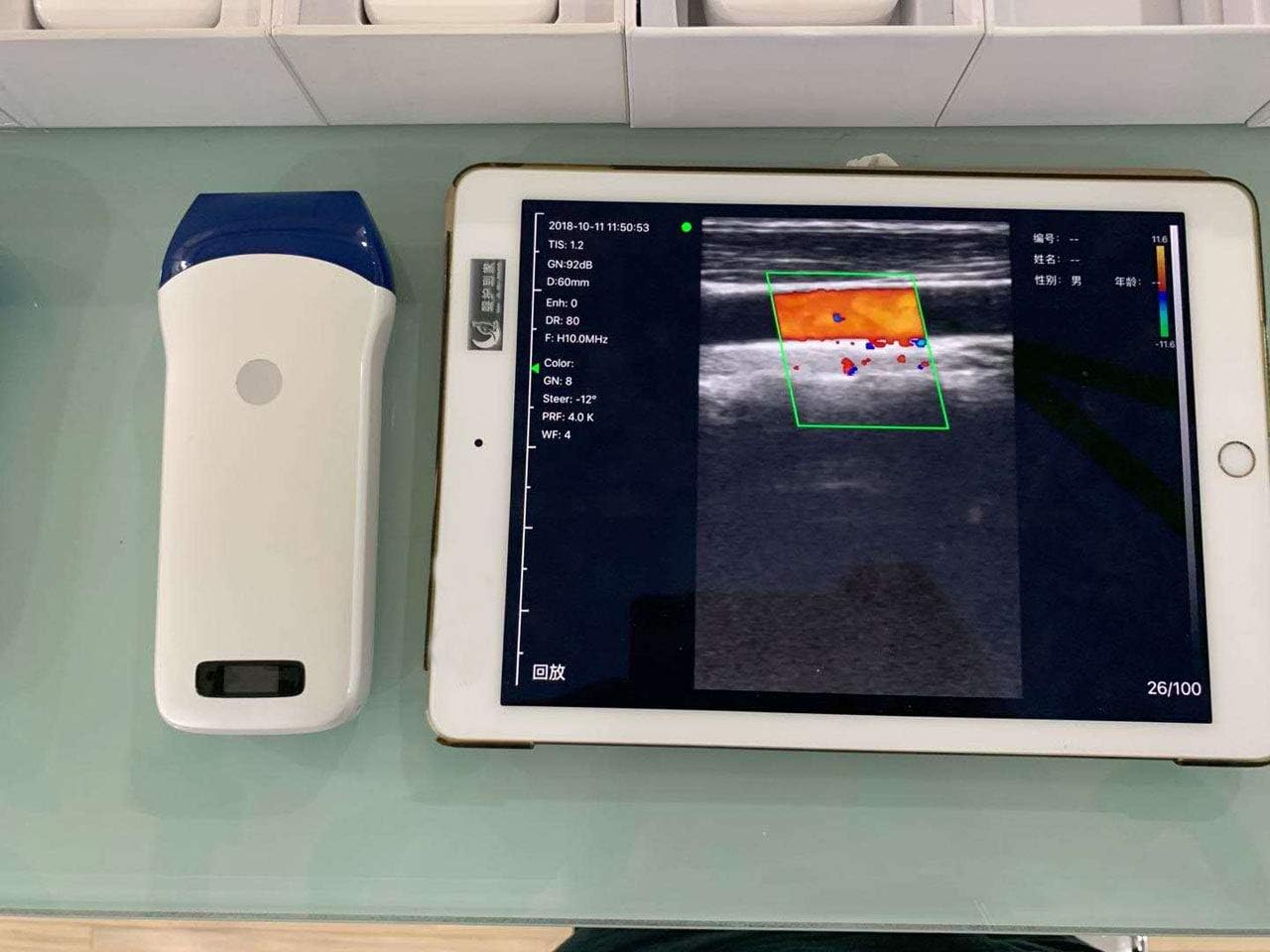 Linear Series Wireless Probe Type Ultrasound Scanner(Deep blue head）
