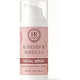 Rosehip & Hibiscus Facial Serum – Brightening, Rejuvenating, Vitamin-Rich Anti-Aging Serum with Rosehip Seed Oil & Hibiscus Extract | Vegan, Lightweight, 1 OZ Airless Pump