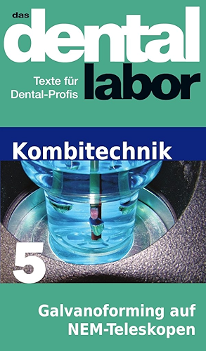 Download Galvanoforming direkt auf NEM-Teleskopen (das dental labor Fachtexte 42) (German Edition) PDF