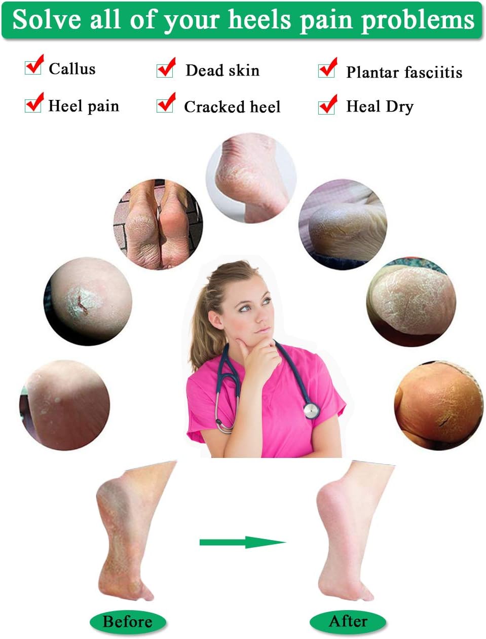 (8PCS) Silicone Heel Protectors,Heel Cups,Gel Heel Cushion,Plantar Fasciitis Inserts Pads& Heel Guards Great fot Heel Pain, Heal Dry Cracked Heels, Achilles Tendinitis.Heel Sore.: Health & Personal Care