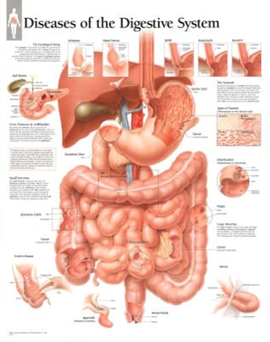 Diseases of Digestive System chart: Laminated Wall Chart in Oman ...