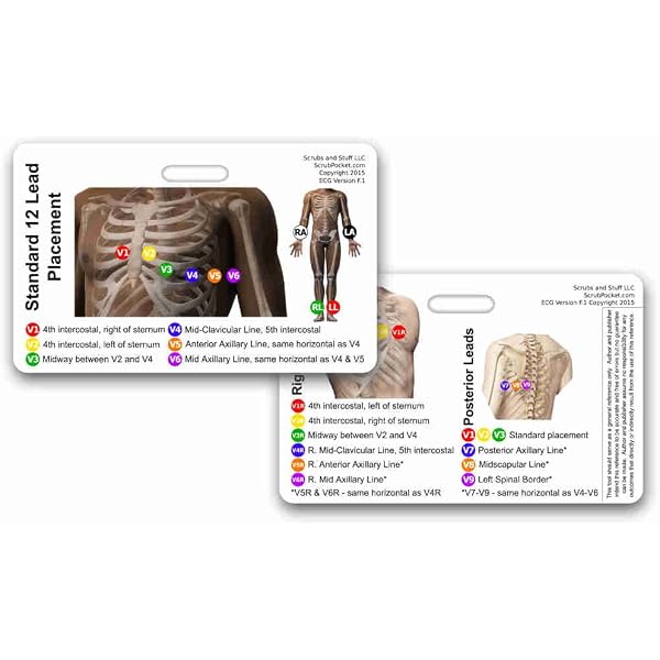 12 Lead Ecg Placement Chart Stemi 12 Lead Reference And 12 Lead Ekg Ecg ...