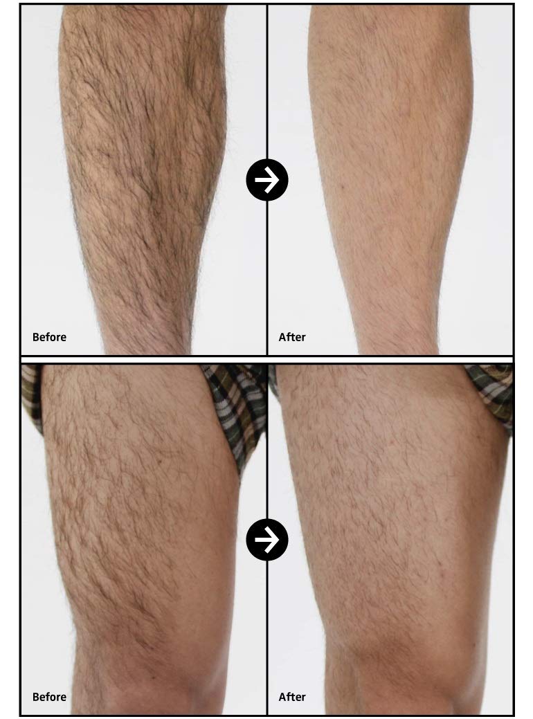Amazon Com Freegrid Leg Trimmer Razor Awsome Item For Body Hair