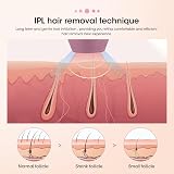 TOPEV IPL Hair Remover, 500,000 Flashes, 5 Energy Levels, Rose Gold view 5