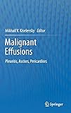 Malignant Effusions: Pleuritis, Ascites, Pericardites