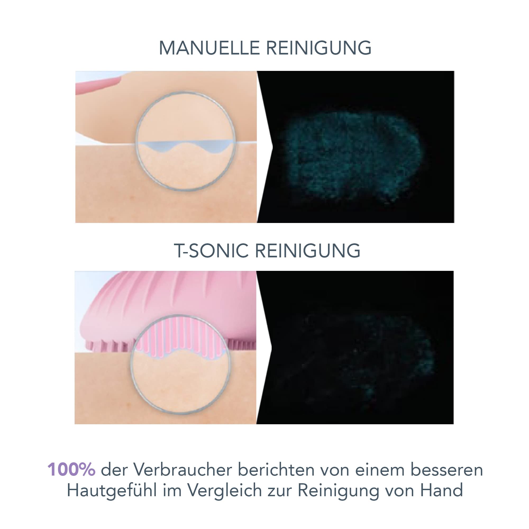 FOREO LUNA 3 Facial Cleansing Brush | Sensitive Skin | Anti Aging Face Massager | Enhances Absorption of Facial Products | For Clean & Healthy Face Care | Simple & Easy | Waterproof