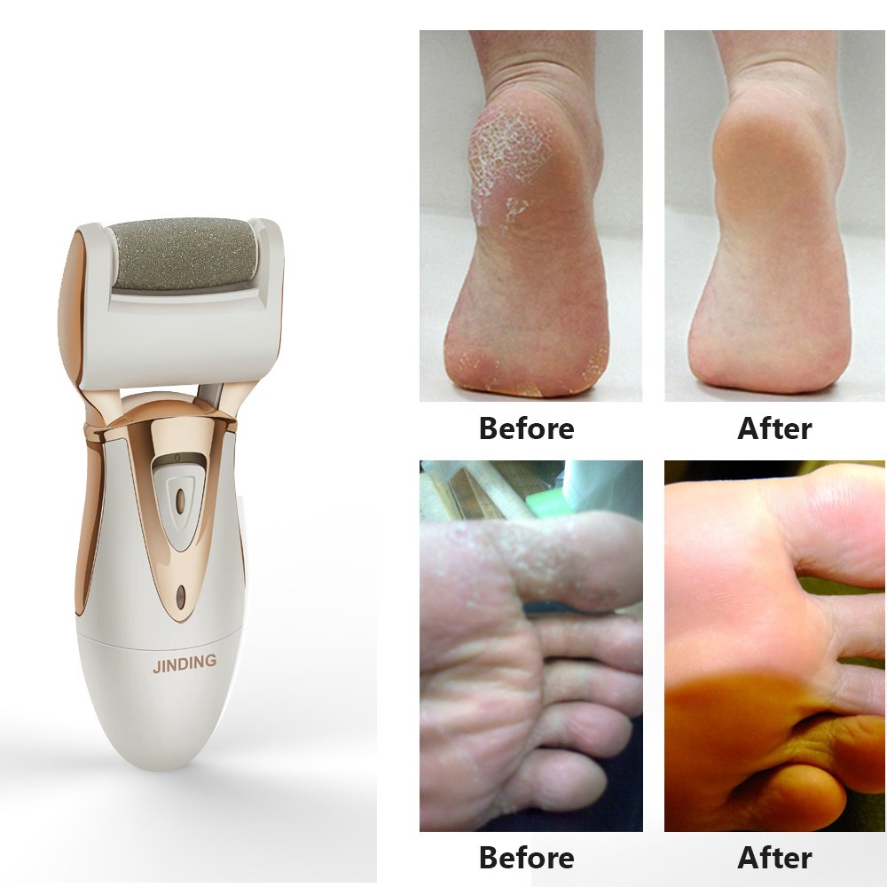 Electric Foot File - Rechargeable & Waterproof Callus Remover with Quartz Sand Remove Dead, Hard, Cracked Skin (Gold)