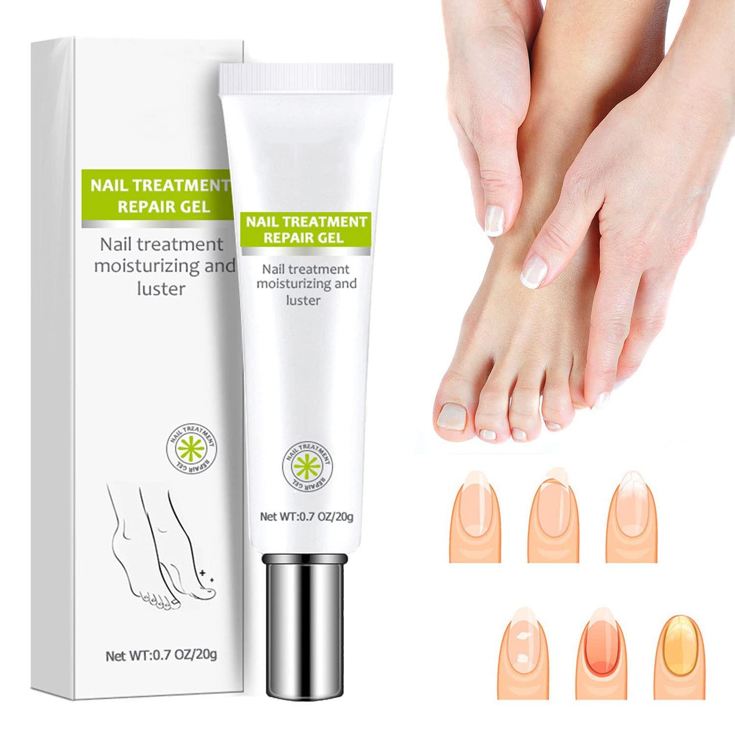 Nail Repair - Nail Treatment Repair Gel/Nail & Toenail Treatment Nail Repair Cream/Toe Be Health Instant Beauty Cream, Renews Yellow, Cracked, Damaged and Split Nails