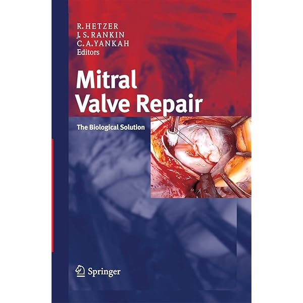Carpentier's Reconstructive Valve Surgery: 9780721691688: Medicine