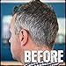 Verseo Anti-Gray Hair Coloring Treatment – Fast and Effective Improved Hair Coloring Formula – Usable as a Hair or Beard Treatment, 8 FL OZ(237 mL)