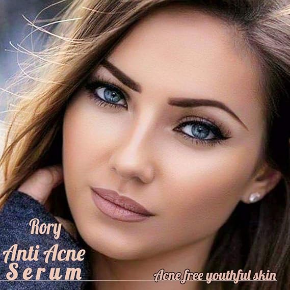 rory anti acne serum