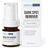 aobenz Dark Spot Remover for Face, Triple Dark Spot Complex Serum | with Tranexamic Acid, Alpha-Arbutin &amp; Niacinamide, Gentle Dark Spot Corrector for Uneven Tone &amp; All Skin Types, 1.35 fl oz