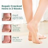 Welnove Moisturizing Heel Socks 2 Pairs Aloe Gel Lining Foot Care view 2