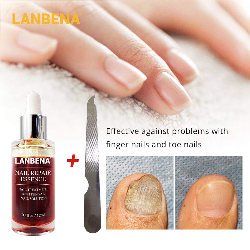 Nails Repair, LANBENA Nail Treatment Nail Care Serum Protect Nail from Damage Fingernail and Toenail Repair for Curing Athlete's Foot and Prevent Nail from Infection Discolored & Damaged Nails(12ml) : Beauty