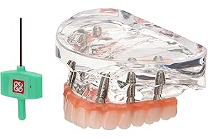 PER4MANCE Dental Implant Model for Upper Jaw: All-on-6 Restoration Demo with Transparent Base, Suitable for Dental Students & Patient Education