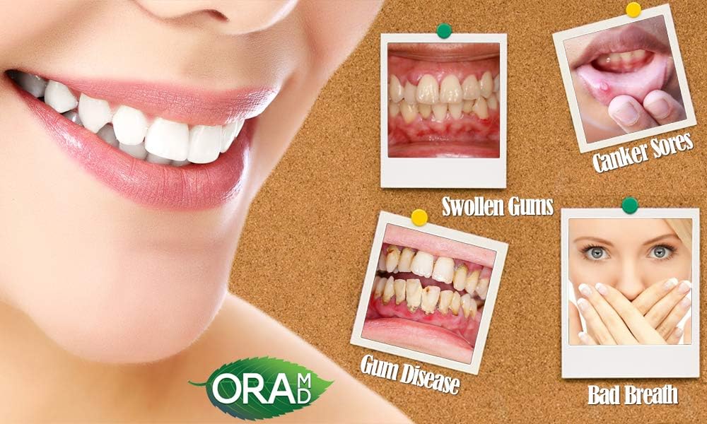 OraMD Original Dentist Recommended Worldwide 100% Pure Breath Freshener for Bad Breath, Halitosis Canker Sores, Gum Boils and Tooth Abscesses - 1 Bottle: Beauty