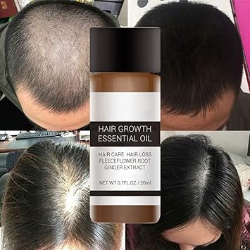 Amazon Com Romantic Bear Hair Growth Essential Oil Fleeceflower