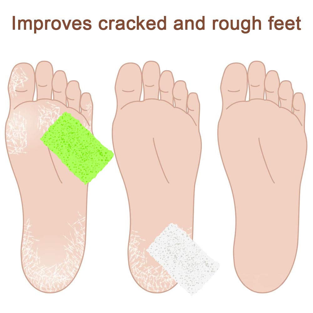 Pumice Stone for Feet, 2 in 1 Double Sided Hard Skin Callus Remover for Feet,Hands and Body, Exfoliator Pedicure File Block Callus Remover Scrubber (Pack of 4): Beauty