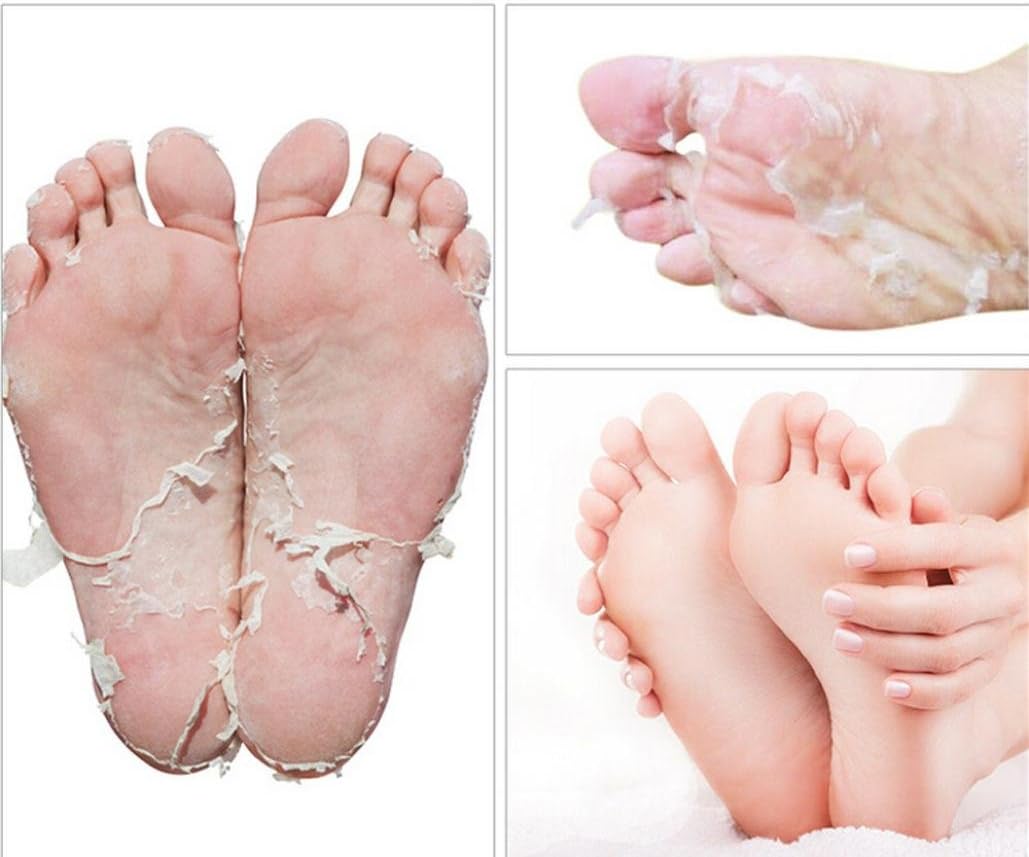 Walaha 2 Pcs/1Bag Foot Peeling Mask,Walaha for Callus Dead Skin, Get Soft Touch Smooth Feet in 1 Week, Repair Rough Heels for Men Women