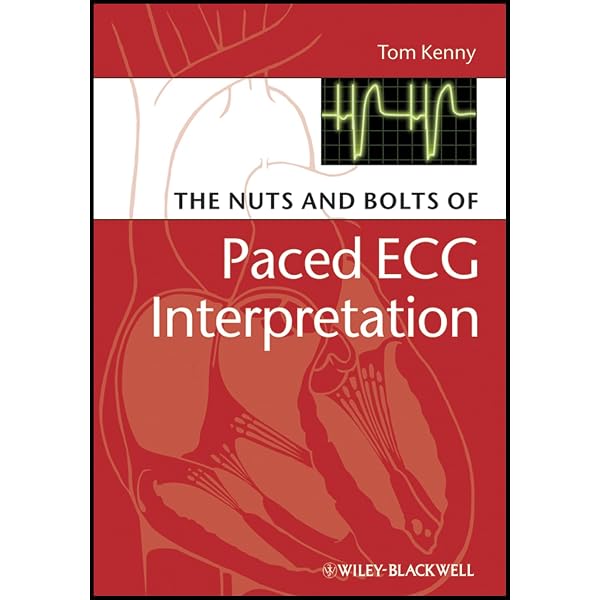 健康・医学 The EHRA Book of Interventional EP Amazon.com: The EHRA