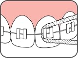 TePe Bridge & Implant Floss Brand TePe Dental Care Kit view 5