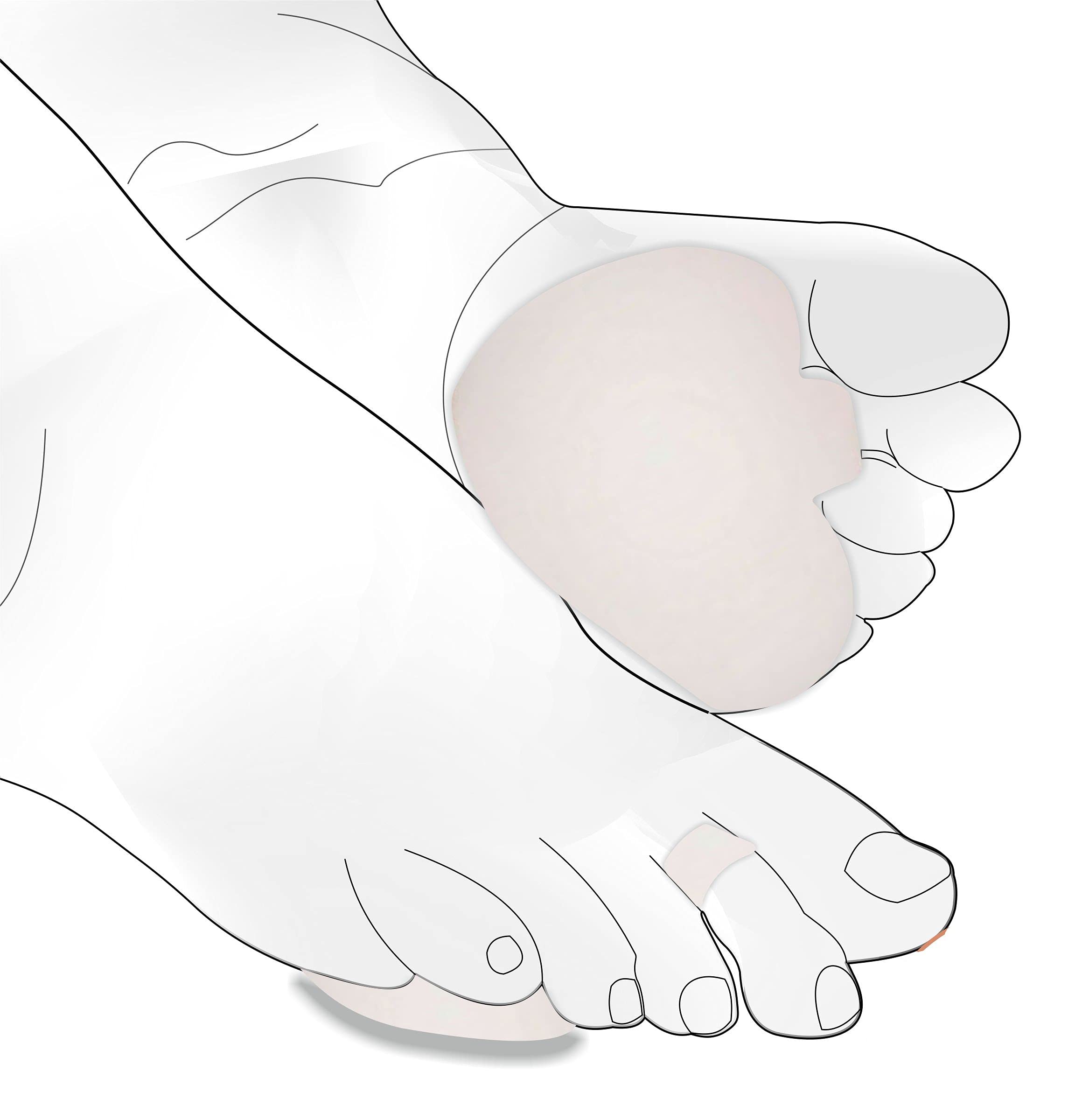 Pedimend 2 Pairs Mortons Neuroma Running Support Pressure Relieving Pads | Metatarsalgia Padding Insole | Rapid Pain Relief Sore Feet | Ball of Foot Soft Cushion | Gel Front Forefoot Metatarsal Sole