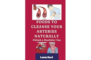 Foods to Cleanse Your Arteries Naturally: Unlock a Healthier You