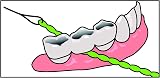 iDontix IDontix Brace X-Floss Green Dental Floss Tool view 4