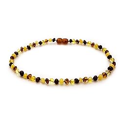 Amber Guru Baltic Amber Necklace
