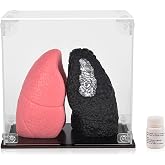 Ultrassist Healthy and Smoker Lung Model, Mini Size | Soft silicone anatomy, black/pink comparison, transparent acrylic dust cover, for smoking education and display