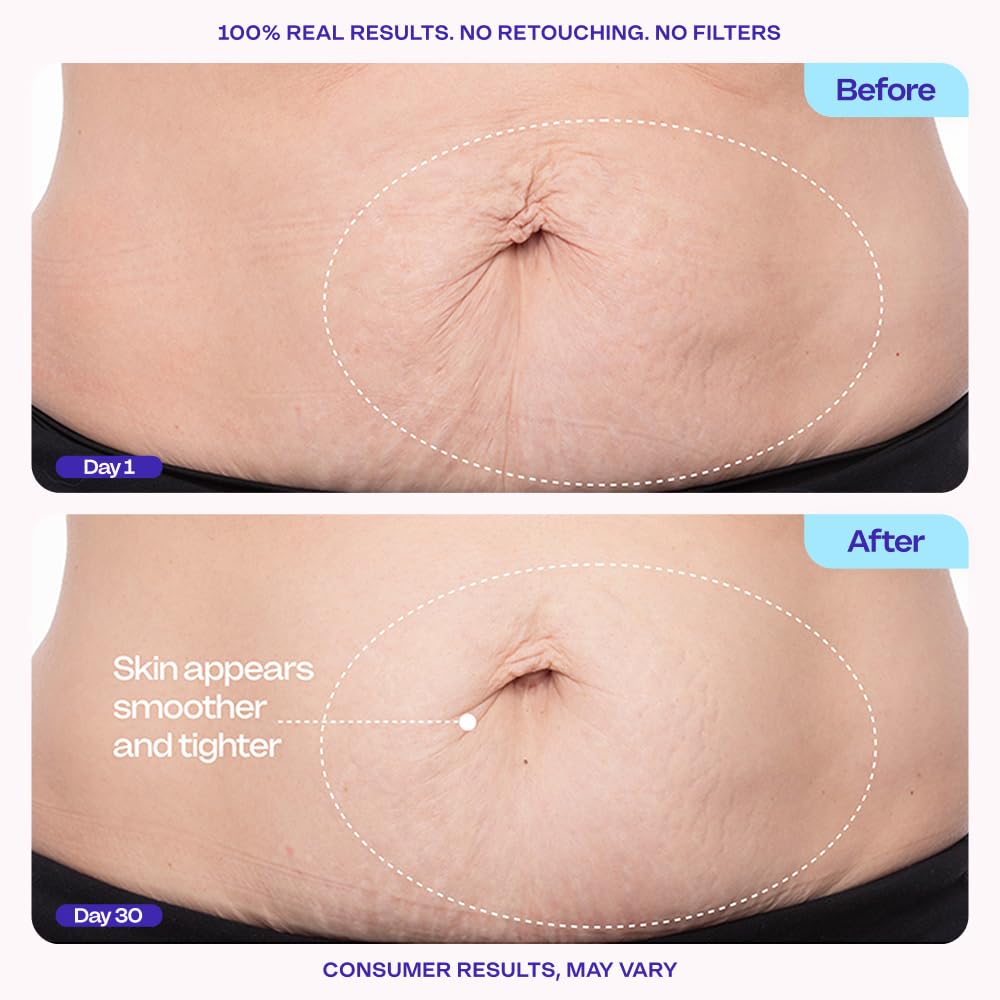 goPure Firming Belly Cream - Body Firming Moisturizer for Visible Cellulite & Stretch Mark Reduction, 4.25oz