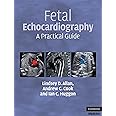 Fetal Echocardiography: A Practical Guide
