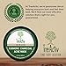 TreeActiv Turmeric Charcoal Acne Mask | Natural Treatment for Facial Blackheads, Severe and Cystic Acne | Clear Skin and Face | Exfoliating | 2 oz