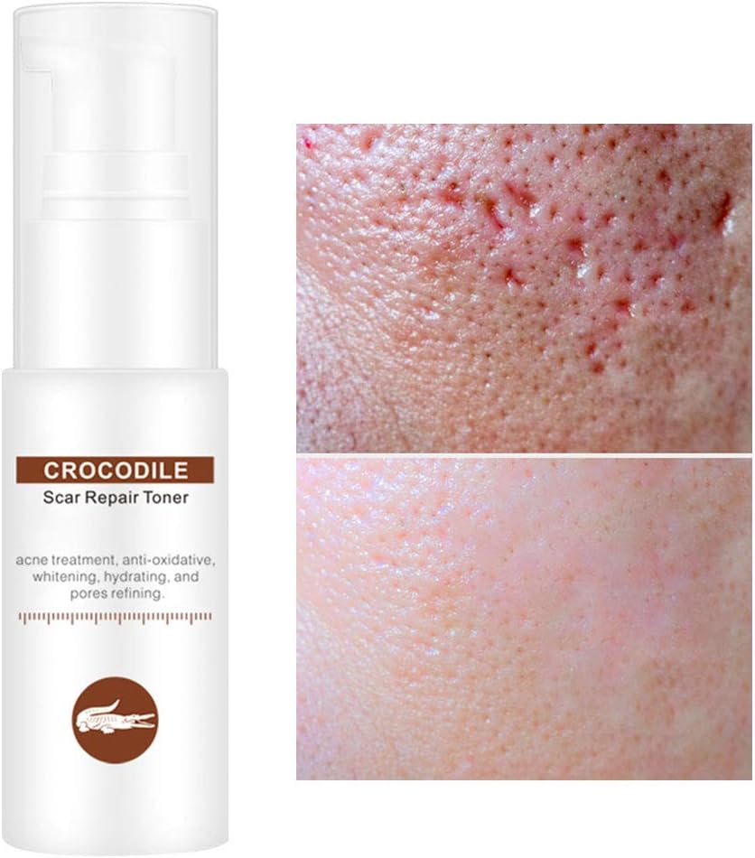 crocodile face toner