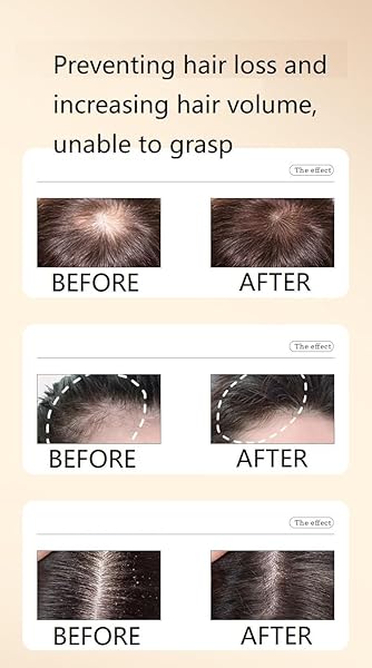 GINGER ANTI HAIR LOSS SHAMPOO, PLANT SHAMPOO FOR HAIR GROWTH OIL CONTROL HAIR CARE FOR WOMEN MEN.(1 BOX)