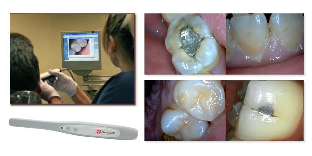 Dental Usb Software Download