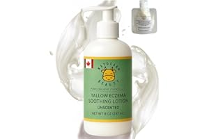 Tallow Eczema Soothing Lotion (UNSCENTED) - Grass-Fed and Finished Tallow Infused with Calendula & Chamomile for Eczema Sensi