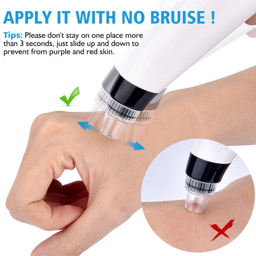 ZCPlus Blackhead Remover Skin Facial Vacuum Pore Cleaner Acne Comedone Extractor USB Rechargeable Pore Sucker Acne Extractor Tool for Beauty Travel Business Trip Gift Man and Women