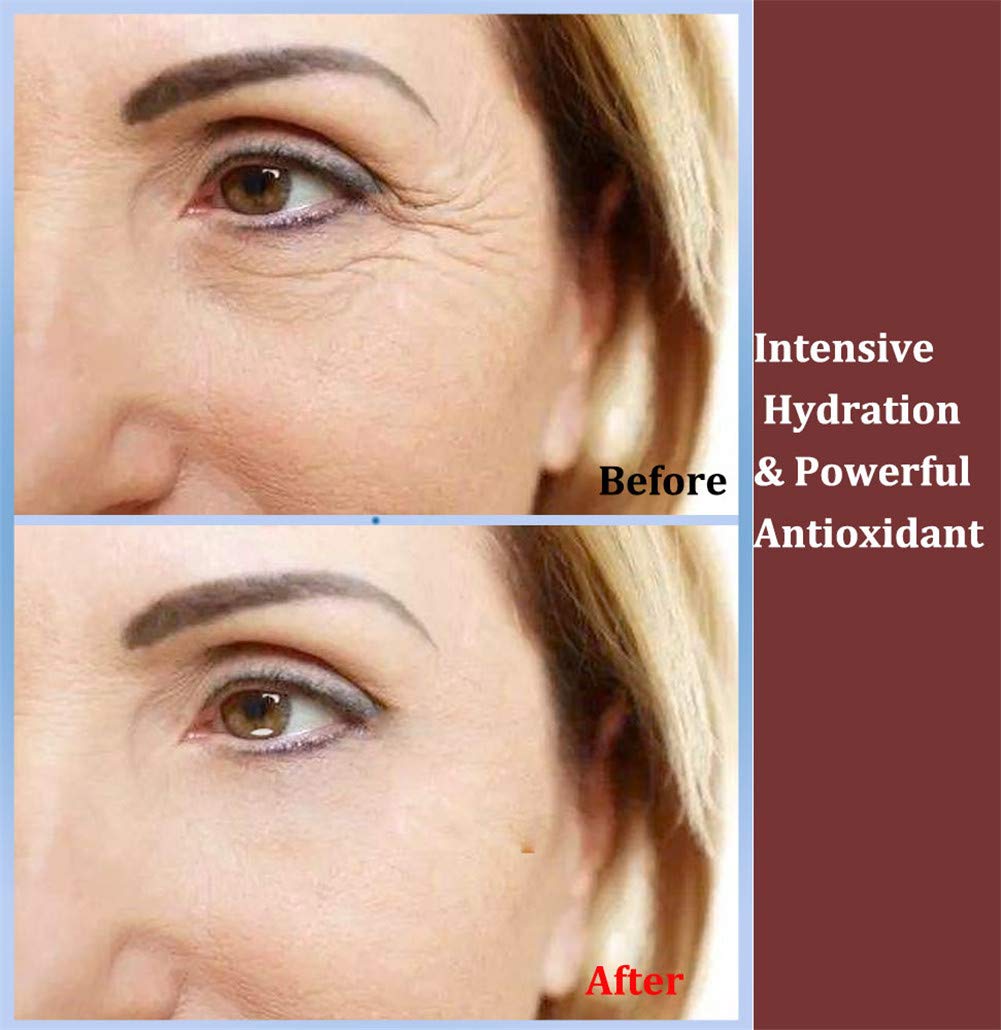 Adofect 30 Pairs Gold Eye Mask Power Crystal Gel Collagen Masks, Great For Anti Aging, Dark Circles & Puffiness : Beauty