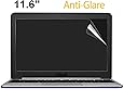 sticker how dust to absorber use 11.6 inch Screen CaseBuy Laptop Anti Amazon.com: Glare sticker how dust to absorber use 11.6 inch Screen CaseBuy Laptop Anti Amazon.com: Glare