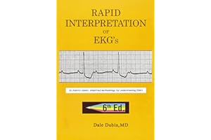 [Rapid Interpretation of EKG's] 6th Edition Paperback