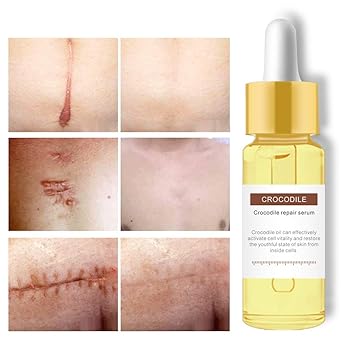 purity stretch mark cream