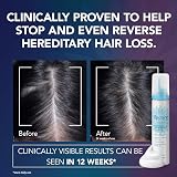 Regaine for Women Hair Growth Foam Minoxidil 2 x 73ml Pack of 2 view 3