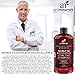 Art Naturals 2 Pack - Scalp18 Coal Tar Therapeutic Anti Dandruff Shampoo 16 oz - Helps clear symptoms of Psoriasis, Eczema, Itchy Scalp & Dandruff - Made in USA with Natural & Organic Ingredients